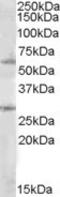 SOCS7 antibody, TA305889, Origene, Western Blot image 