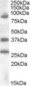 Homeobox protein Hox-D10 antibody, STJ71706, St John