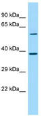 SDA1 Domain Containing 1 antibody, TA333758, Origene, Western Blot image 