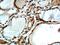 n-myc antibody, 10159-2-AP, Proteintech Group, Immunohistochemistry frozen image 