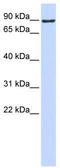 ATM Interactor antibody, TA330575, Origene, Western Blot image 