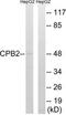 Carboxypeptidase B2 antibody, TA313671, Origene, Western Blot image 