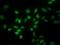 Eukaryotic Translation Initiation Factor 1 antibody, NBP2-00702, Novus Biologicals, Immunocytochemistry image 