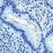 Helicobacter pylori antibody, NB120-7788, Novus Biologicals, Immunohistochemistry paraffin image 