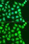 UbiA prenyltransferase domain-containing protein 1 antibody, GTX55833, GeneTex, Immunofluorescence image 