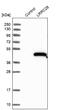 Leucine Rich Repeat Containing 28 antibody, NBP2-48706, Novus Biologicals, Western Blot image 