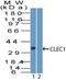 C-Type Lectin Domain Family 1 Member A antibody, NBP2-27096, Novus Biologicals, Western Blot image 