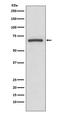 Prostaglandin-Endoperoxide Synthase 1 antibody, M00811, Boster Biological Technology, Western Blot image 