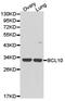 B-cell lymphoma/leukemia 10 antibody, TA326930, Origene, Western Blot image 
