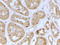 Nucleolar And Coiled-Body Phosphoprotein 1 antibody, TA326311, Origene, Immunohistochemistry paraffin image 