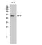 5-Hydroxytryptamine Receptor 3D antibody, GTX34001, GeneTex, Western Blot image 