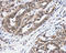 BCL2 antibody, GTX100064, GeneTex, Immunohistochemistry paraffin image 
