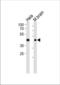 TARDBP antibody, TA324524, Origene, Western Blot image 