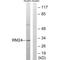 Mitochondrial Ribosomal Protein L24 antibody, A15563, Boster Biological Technology, Western Blot image 
