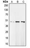 MOK Protein Kinase antibody, LS-C352758, Lifespan Biosciences, Western Blot image 