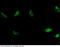 KI-67 antibody, 13180-MM01, Sino Biological, Immunohistochemistry paraffin image 