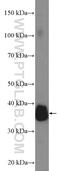 Ornithine Carbamoyltransferase antibody, 26470-1-AP, Proteintech Group, Enzyme Linked Immunosorbent Assay image 