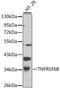 TNF Receptor Superfamily Member 6b antibody, STJ25896, St John