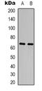 Dihydropyrimidinase Like 2 antibody, orb339013, Biorbyt, Western Blot image 