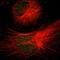 Gamma-sarcoglycan antibody, HPA007476, Atlas Antibodies, Immunofluorescence image 