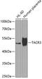 NK3R antibody, GTX65956, GeneTex, Western Blot image 