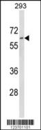 Dolichol Kinase antibody, 63-662, ProSci, Western Blot image 