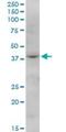 F-Box Protein 28 antibody, H00023219-B01P, Novus Biologicals, Western Blot image 