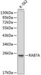 RAB7A, Member RAS Oncogene Family antibody, 14-046, ProSci, Western Blot image 