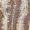 Matrix Metallopeptidase 25 antibody, A3032, ABclonal Technology, Immunohistochemistry paraffin image 