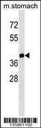 Zinc finger protein ZPR1 antibody, 58-715, ProSci, Western Blot image 