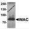 WW Domain Containing Adaptor With Coiled-Coil antibody, 7293, ProSci, Western Blot image 