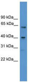 Sst2 antibody, TA342653, Origene, Western Blot image 