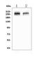 CAIN antibody, A02408-1, Boster Biological Technology, Western Blot image 