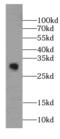 Succinate dehydrogenase assembly factor 2, mitochondrial antibody, FNab01010, FineTest, Western Blot image 