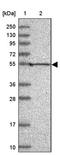 Potassium Voltage-Gated Channel Subfamily A Member Regulatory Beta Subunit 1 antibody, PA5-60743, Invitrogen Antibodies, Western Blot image 