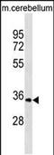 Uridine-cytidine kinase 1 antibody, PA5-49001, Invitrogen Antibodies, Western Blot image 