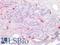 Tryptase antibody, LS-B16494, Lifespan Biosciences, Immunohistochemistry paraffin image 