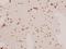 DLG Associated Protein 1 antibody, A08230, Boster Biological Technology, Immunohistochemistry paraffin image 