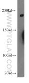 Dedicator of cytokinesis protein 8 antibody, 11622-1-AP, Proteintech Group, Western Blot image 