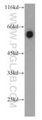 Sulfated glycoprotein 1 antibody, 10801-1-AP, Proteintech Group, Western Blot image 