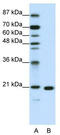 Ribosomal Protein L9 antibody, TA345685, Origene, Western Blot image 