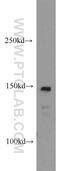 Centrosome and spindle pole-associated protein 1 antibody, 11931-1-AP, Proteintech Group, Western Blot image 