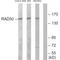 DNA repair protein RAD50 antibody, A00347, Boster Biological Technology, Western Blot image 
