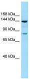 Cytoplasmic FMR1 Interacting Protein 1 antibody, TA338086, Origene, Western Blot image 