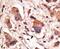 Melanoma-associated antigen D1 antibody, PA5-13162, Invitrogen Antibodies, Immunohistochemistry frozen image 