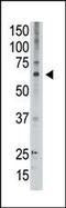 MAGE Family Member D2 antibody, PA5-13163, Invitrogen Antibodies, Western Blot image 