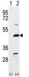 Bone Morphogenetic Protein 7 antibody, AP11668PU-N, Origene, Western Blot image 