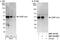 CCAAT Enhancer Binding Protein Beta antibody, NBP1-46179, Novus Biologicals, Western Blot image 