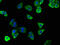V-type proton ATPase subunit d 2 antibody, CSB-PA818735LA01HU, Cusabio, Immunofluorescence image 