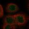 Abhydrolase Domain Containing 18 antibody, NBP2-30812, Novus Biologicals, Immunocytochemistry image 